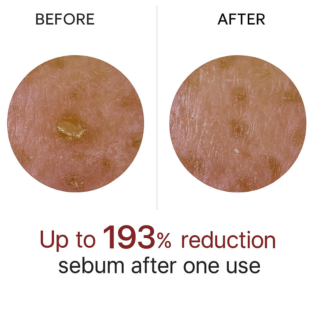 Advanced Black Rice Exfoliating Ampoule LumaPeel™