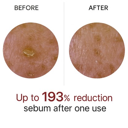 Advanced Black Rice Exfoliating Ampoule LumaPeel™